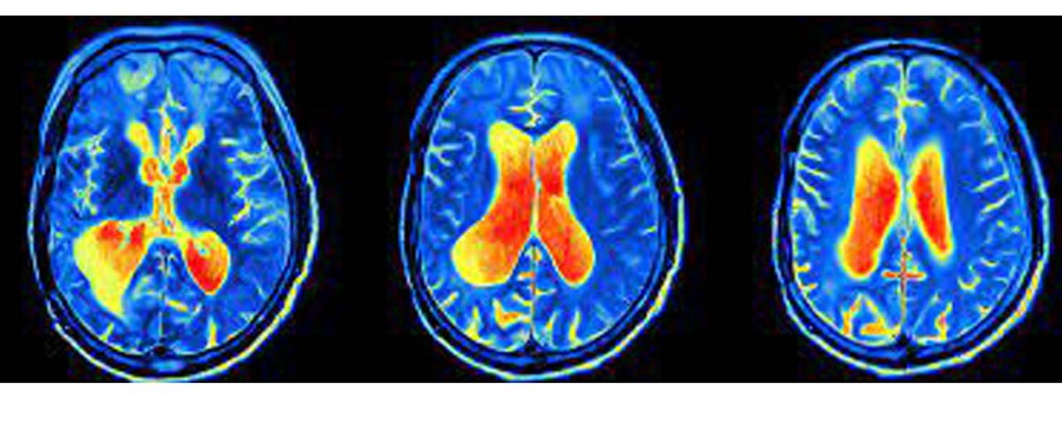 پزشکی هسته ای